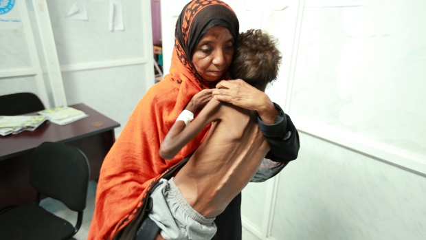 امرأة يمنيّة تحمل طفلها الذي يعاني من سوء التغذية/Abduljabbar Zeyad/Reuters
