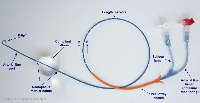 The ER-REBOA device (via MUHC)