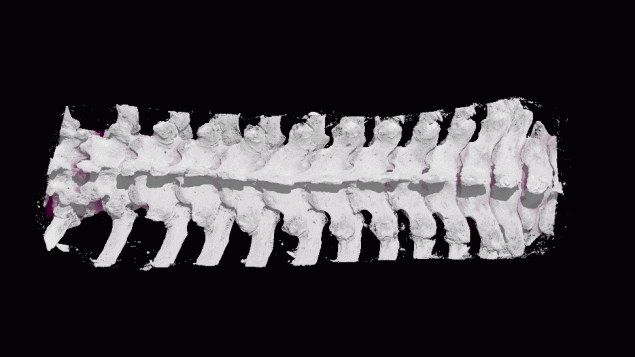 Using mouse models and human cadaver spines, new research in Canada advances knowledge of a spinal disease "DISH" (University of Western Ontario)