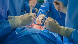 Researchers find simple surgery prevents strokes in heart patients