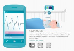 Seguimiento a domicilio, una de las innovaciones de Bioserenity. Foto: http://www.bioserenity.com/