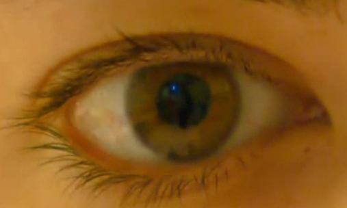 Long wait times for eye care in Nunavut, Canada are a concern to patients. (CBC.ca)