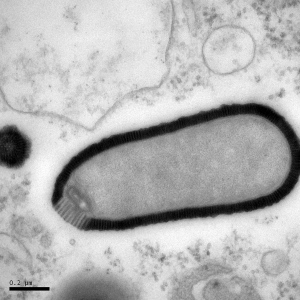 Virus géant trouvé dans du pergélisol de 30 000 ans et qui a réussi à infecter une amibe lorsque ranimé (Courtoisie: Julia Bartoli et Chantal Abergel, IGS et CNRS-AMU)