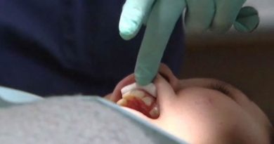 The federal government is spending a million dollars to send five chartered plane loads of Nunavut children to the hospital in Churchill, Man., for dental surgery. (from CBC.ca)