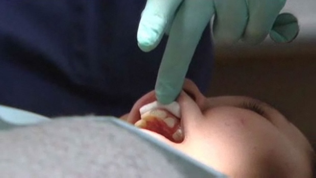 The federal government is spending a million dollars to send five chartered plane loads of Nunavut children to the hospital in Churchill, Man., for dental surgery. (from CBC.ca)