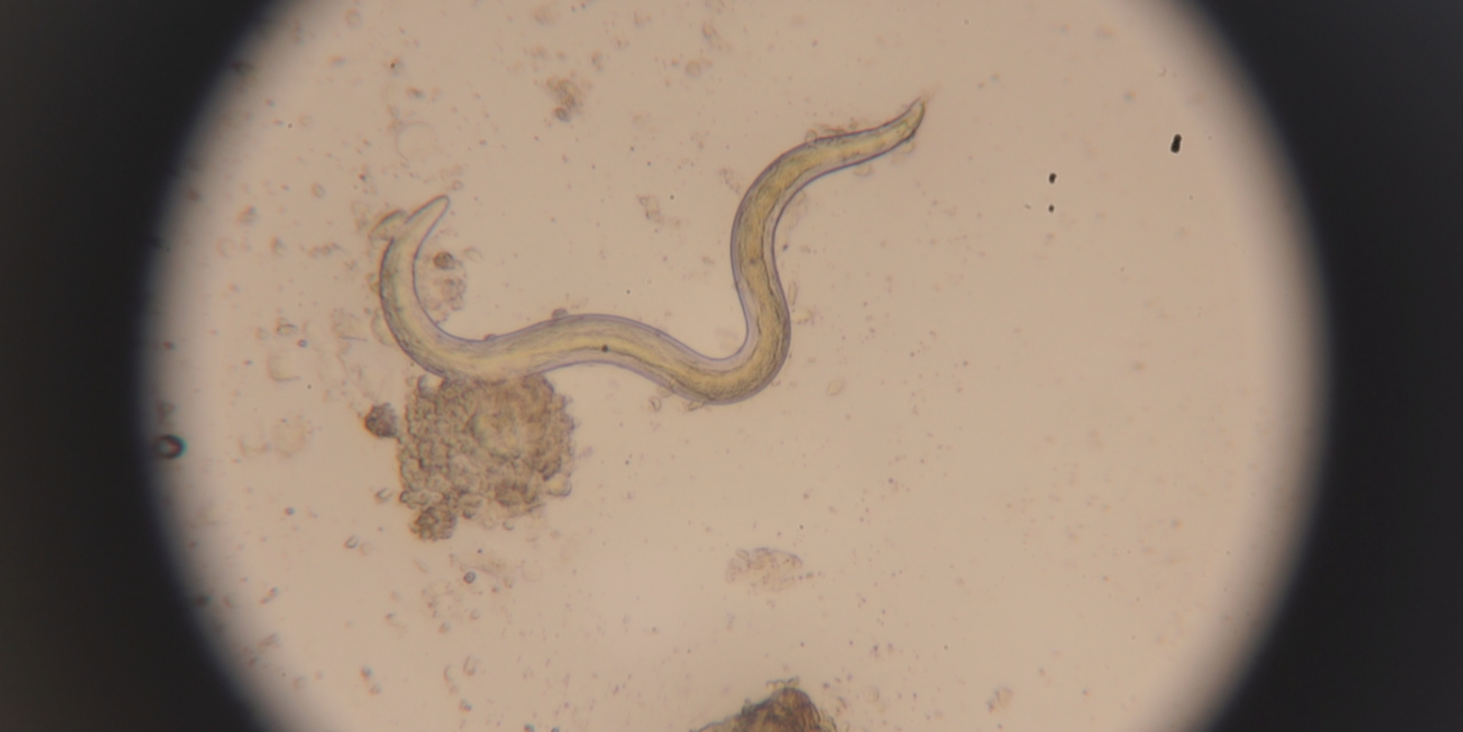 The first parasite named in Inuinnaqtun. (Eye on the Arctic)