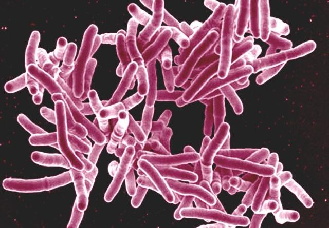 alaska-tuberculosis-rate-dips-but-still-among-the-u-s-highest