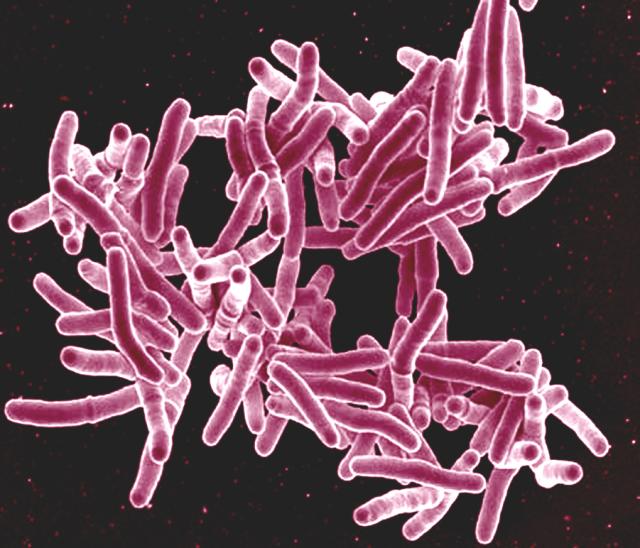 alaska-tuberculosis-rate-dips-but-still-among-the-u-s-highest