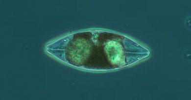 A photo of navicula imperfecta taken from a sample near Iqaluit, Nunavut.