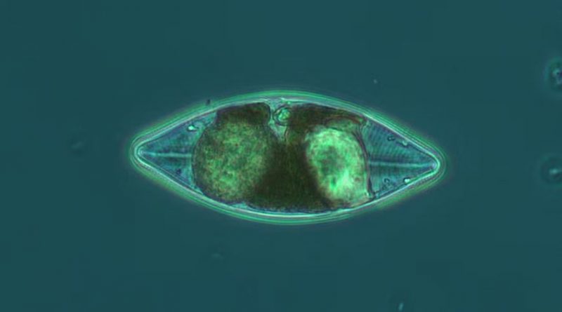 A photo of navicula imperfecta taken from a sample near Iqaluit, Nunavut.