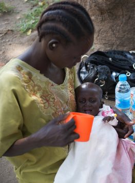 SSUDAN-MALNUTRITION