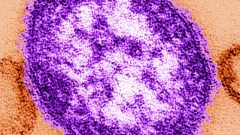 Le virus de la rougeole montré aux micrographies électroniques.... (Photo Archives La Presse Canadienne)