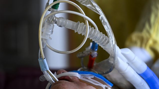 Les médecins ont peu à peu abandonné le recours systématique aux respirateurs - Photo : La Presse Canadienne / Nathan Denette