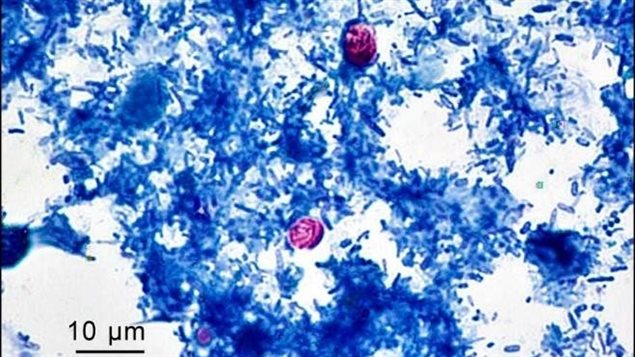 En rouge, le Cryptosporidium, un parasite intestinal microscopique © Dr. Katherine Thivierge (Laboratoire de santé publique du Québec, Institut national de santé publique