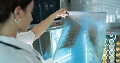 Une personne tient une radiographie.