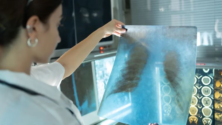 Une personne tient une radiographie.