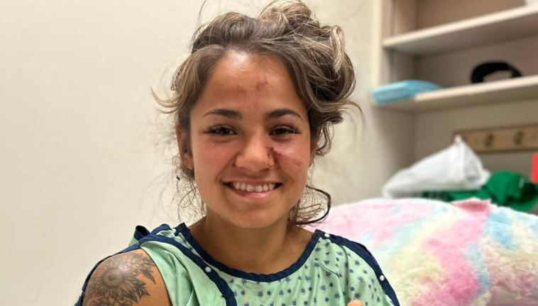 Une femme ayant des éraflures au visage sourit à la caméra.