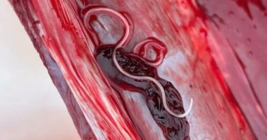 Un ver long et filiforme dans un morceau de viande de caribou.