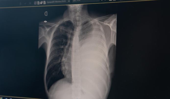 Photo d'une radiographie. 