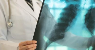 Une personne en blouse blanche tient une radiographie de poumons.