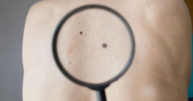 Une loupe cible des grains de beauté dans le dos d'une personne.