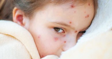 La fillette a des boutons sur le visage et est couchée dans son lit.