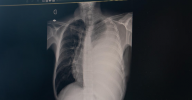 Photo d'une radiographie.