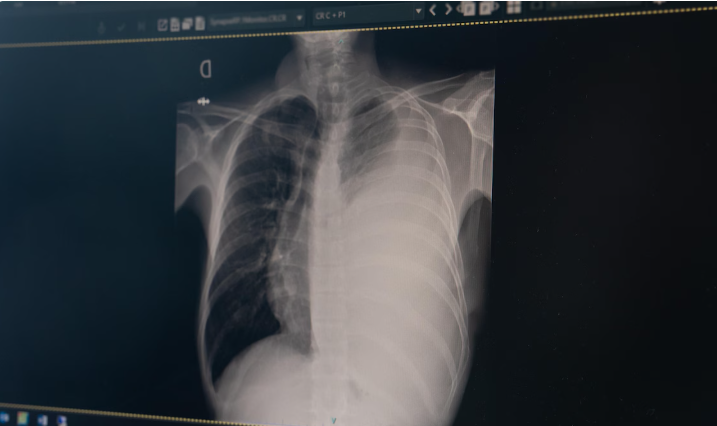 Photo d'une radiographie.