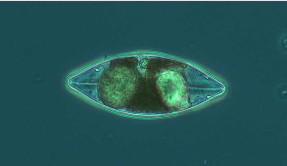 Un phytoplancton photographié au microscope.