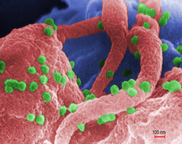 CDC/Canadian Press